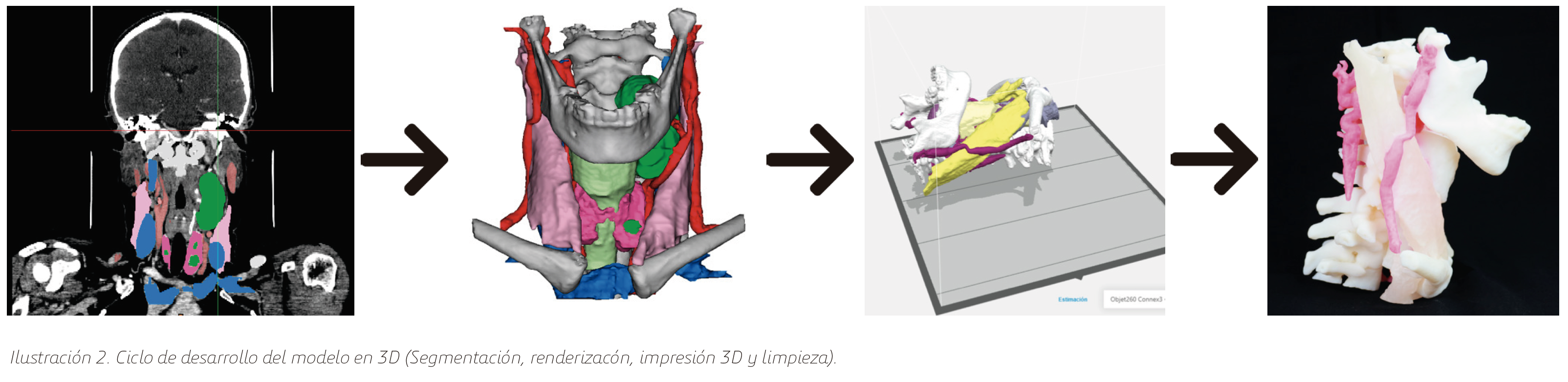 ciclo de atencion medica para diagnostico de infeccion de mandibula