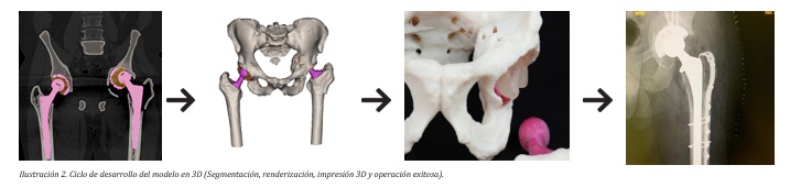 ciclo medico cadera